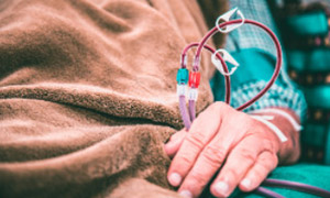 Specific Classification of Coronary Stents