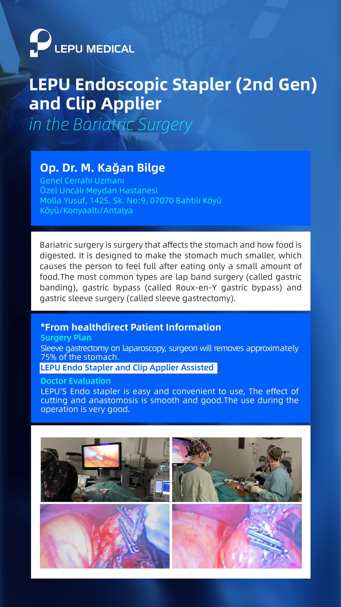 Bariatric Surgery with LEPU 2nd Gen Endoscopic Stapler & Clip Applier!