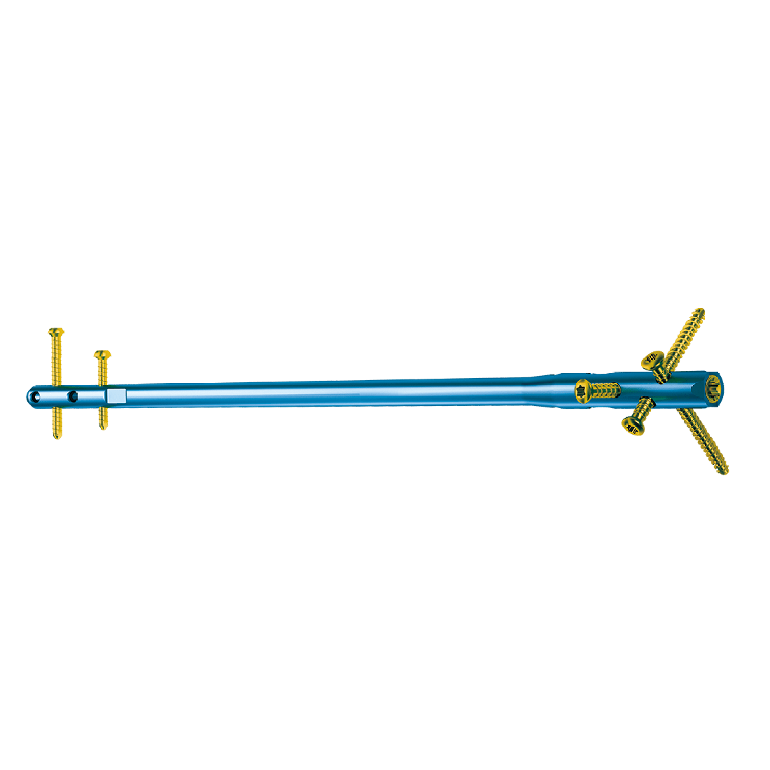 Système de verrouillage des ongles intramédullaires