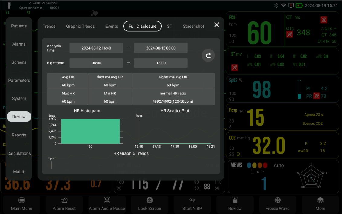 Early Warning ScoreEWS  HRV analysis
