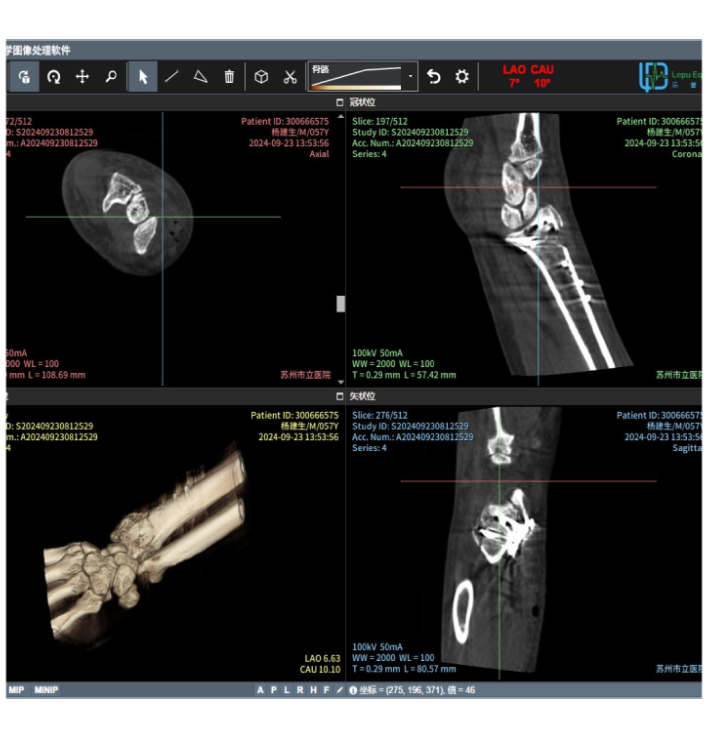 Product Features 1. Lowdose Control